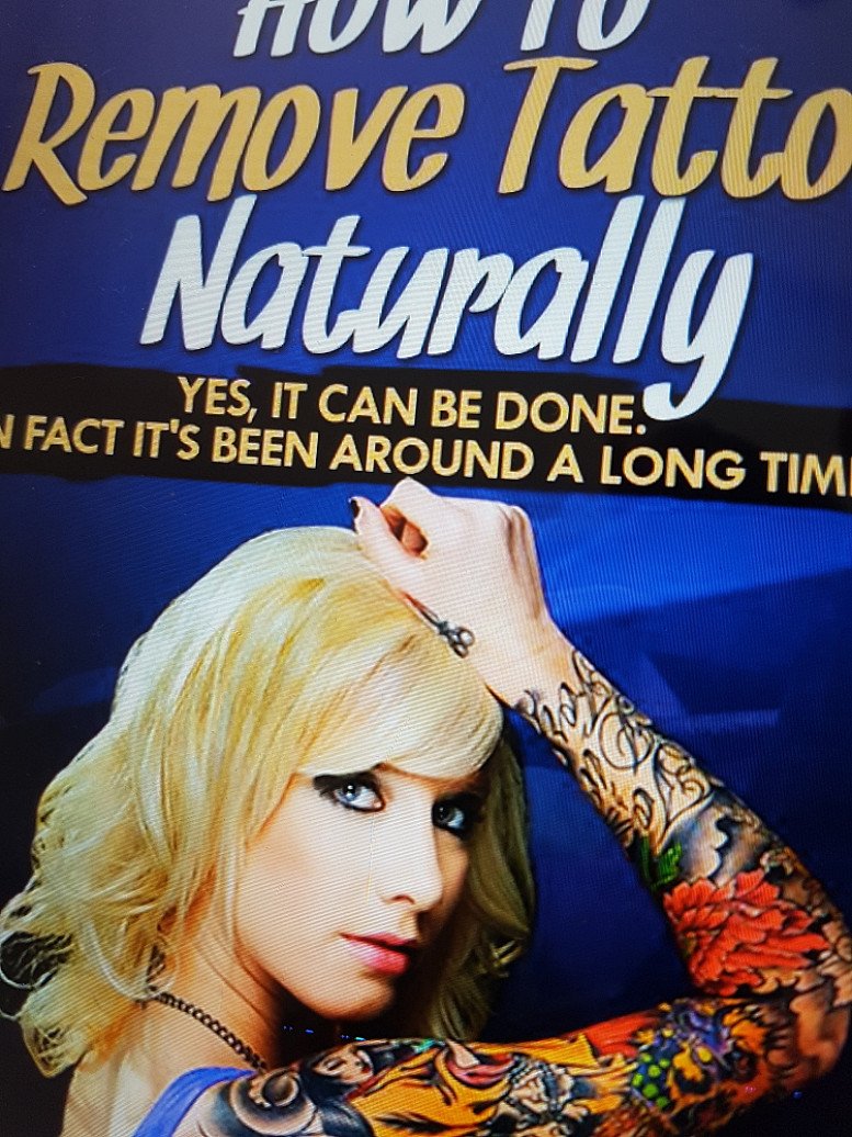 Top Cony-Laserless Tattoo Removal