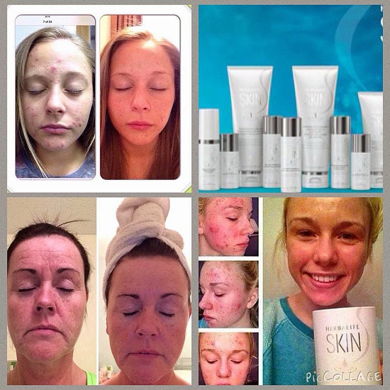 Herbal Aloe Skin Care 7 Day Results Kit